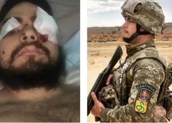 Brasileiro fere pernas e perde visão de um olho ao pisar em mina na Ucrânia