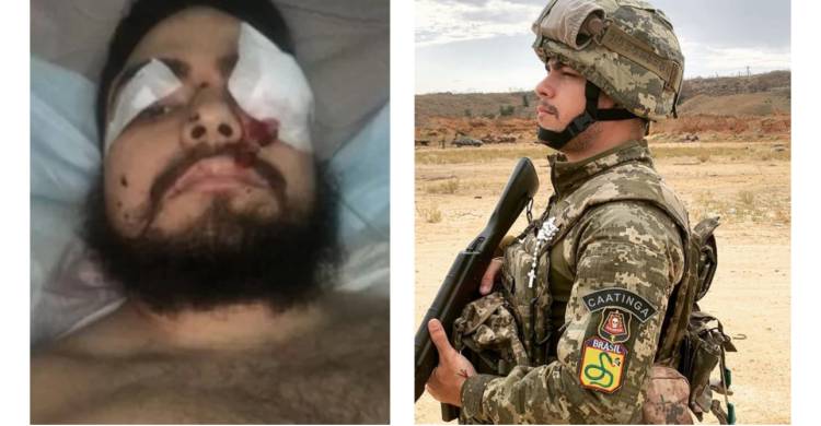 Brasileiro fere pernas e perde visão de um olho ao pisar em mina na Ucrânia