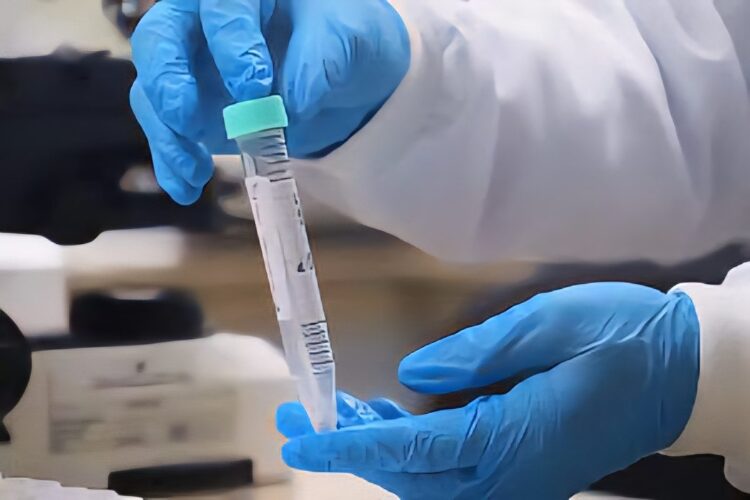 FVS-RCP registra redução de casos de mpox no Amazonas