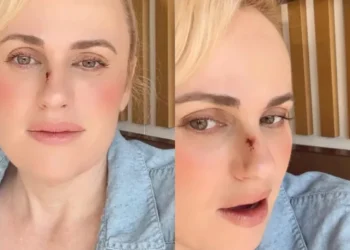 Rebel Wilson e o acidente no filme