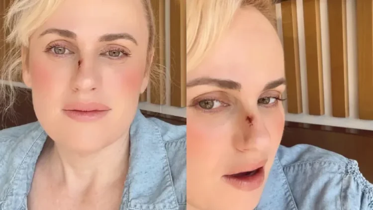 Rebel Wilson e o acidente no filme