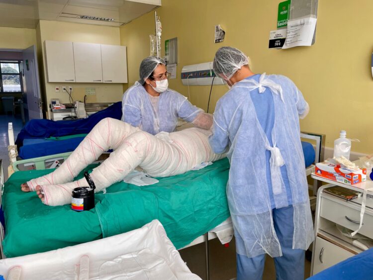 Referência para o SUS, Centro de Tratamento de Queimados do HPS 28 de Agosto ganha importância estratégica na região