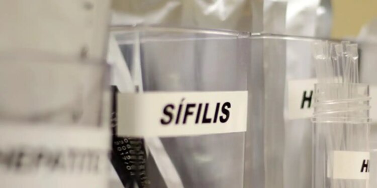 Sífilis continua em ritmo acelerado de crescimento no país