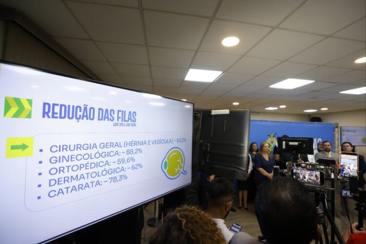 Governador Wilson Lima apresenta nova fase do Opera+ Amazonas programa se torna estratégia permanente para reduzir tempo de espera de cirurgias