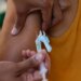 Com 13 casos de sarampo, São Paulo alerta para reforço na vacinação